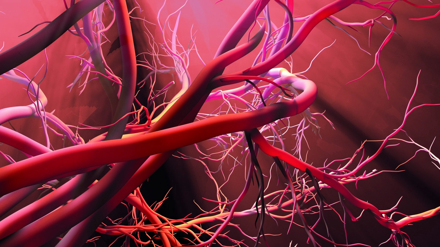 Gefässarzt in Münster